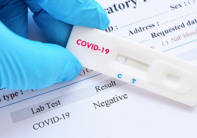Coronavirus : les tests existants