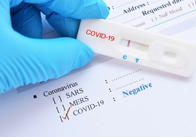 Santé : le test COVID n&rsquo;est plus gratuit, ni remboursé